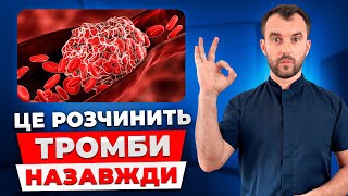 Як врятувати себе від тромбів Зробіть це і тромби пройдуть назавжди [upl. by Yddeg861]