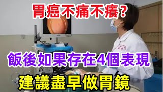 胃癌不痛不癢？醫生提醒：飯後如果存在4個表現，建議盡早做胃鏡。健康常識養生保健健康健康飲食 [upl. by Abernon]