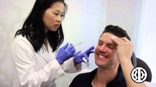 Botox to treat crows feet and frown lines [upl. by Tiphane]