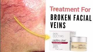 How to Treat Broken Blood VesselsCapillaries on Your Face [upl. by Oel]