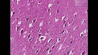 Histopathology BrainRabies [upl. by Attevroc]