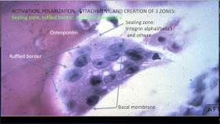 Learning Bone Growth 3 The Osteoclast [upl. by Einallem]