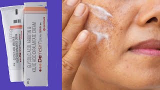 Demelan cream complete Information  Remove Pigmentation Acne scars Pimple marks [upl. by Nairadal]