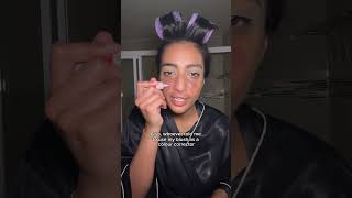 GRWM scalp eczema  eczema scars [upl. by Ney]