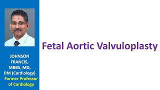 Fetal aortic valvuloplasty [upl. by Naor]