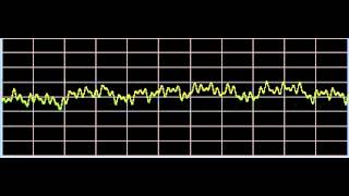 Vitiligo  Rife Frequencies [upl. by Gilberte]