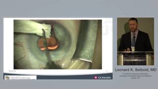 LEONARD SEIBOLD MD  Results with the Kahook Dual Blade KDB EYE NEWS TV [upl. by Notlimah956]