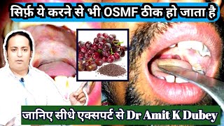 सिर्फ़ इसे खाने से OSMF ठीक होता हैं। OSMF submucousfibrosis  ओज treatment in India [upl. by Codee785]