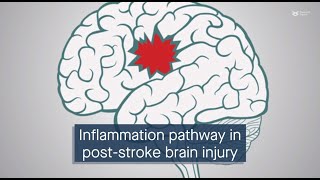 cGAScGAMPSTING signaling mediates brain injury after subarachnoid hemorrhage [upl. by Eejan601]