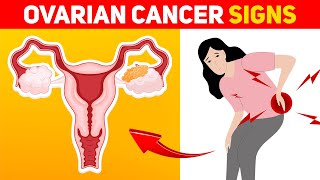 9 Warning Signs of Ovarian Cancer Every Woman Should Know [upl. by Kenlee]