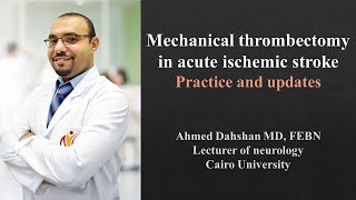 Endovascular therapy in AIS  Practice and updates  DrAhmed Dahshan [upl. by Odlauso]