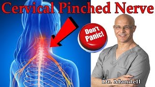 How to Overcome Cervical Pinched Nerve amp Radiculopathy Dont Panic  Dr Alan Mandell DC [upl. by Legra]