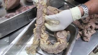 Anatomy Dissection of Large amp Small Intestine [upl. by Aniteb589]