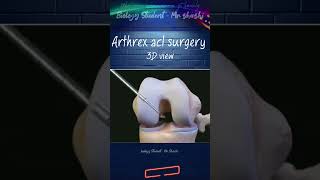 Arthrex acl surgery shorts shortsfeed trending viralvideo ytshorts biology science 3d [upl. by Sivie]