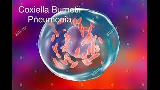 Coxiella burnetii pneumonia [upl. by Savell554]