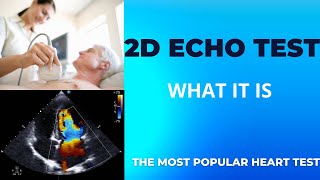 2d echo test with Doppler  2d Echocardiogram  heart scan  Dr MALLESWARA RAO CARDIOLOGIST [upl. by Alexandro]