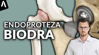 Endoproteza stawu biodrowego I Czy jest KONIECZNA dla Twoich bioder I Fizjomate [upl. by Forrest57]