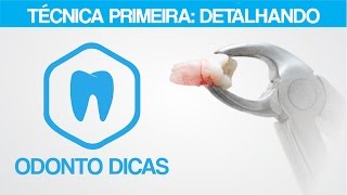 TÉCNICA PRIMEIRA DETALHANDO  ODONTO DICAS [upl. by Agamemnon]