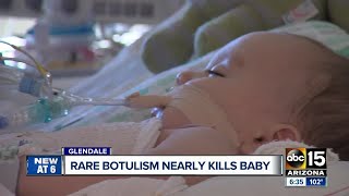 Rare botulism case nearly kills Valley baby [upl. by Savitt551]