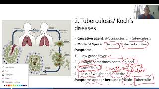 Bacterial Diseases Science ampTech upsc viralvideo pcs upsc [upl. by Aidan]