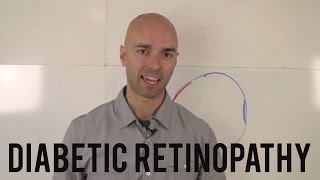 Diabetic Retinopathy What You Need to Know [upl. by Ahsiner]