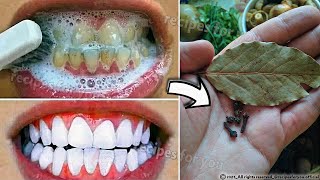 Secret that Dentists dont want you to know Remove Tartar and Teeth Whitening in just 2 minutes [upl. by Lunetta]