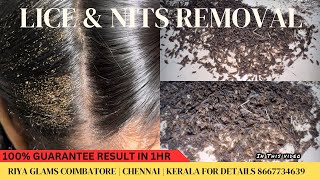 How to remove Lice from Hairhow to remove Lice permanentlyhow to prevent from LiceLice removal￼ [upl. by Ramma]