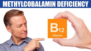 The 1st Sign of a Methylcobalamin B12 Deficiency [upl. by Kahl]