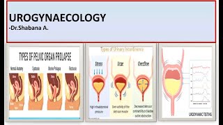 UROGYNAECOLOGY SESSION  CystocelePOPduring pregnancy amp UrodynamicsGraph Interpretation made easy [upl. by Reg]