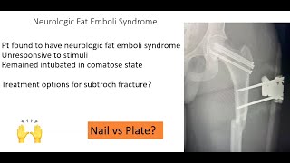 Peritrochanteric femur fractures  Do they all need to be nailed [upl. by Yauqram]