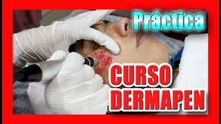 🔴 DERMAPEN  CURSO GRATIS 2021🏆  Demostración paso a paso Dr Sergio Zerpa MICRONEEDLING TUTORIAL [upl. by Lanos]