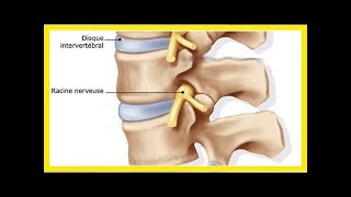 Voici comment réparer vos disques intervertébraux [upl. by Anikas]
