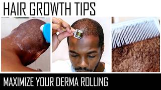 Derma Rolling for Hair Regrowth  Genuine Tips [upl. by Llenwahs956]