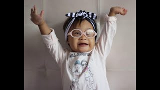 6 months with Veda  Down Syndrome Adoption  India [upl. by Yekcir90]