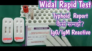 Widal Rapid Test  Typhoid Anitibodies detection Test  Widal Test Report [upl. by Aiyn415]