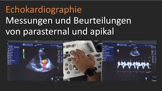 Echokardiographische Messungen und kardiale Beurteilungen von parasternal und apikal [upl. by Magdala]