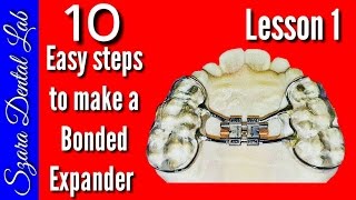 How to make a Orthodontic Bonded palatal expander [upl. by Shulock249]