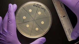 ID Laboratory Videos Antibiotic susceptibility testing [upl. by Halden]