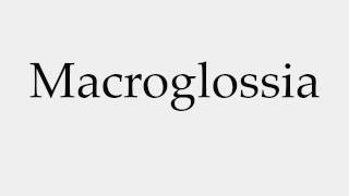 How to Pronounce Macroglossia [upl. by Polak]