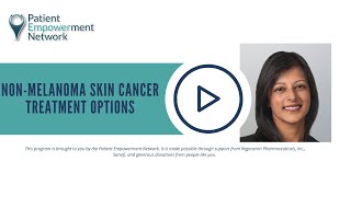 NonMelanoma Skin Cancer Treatment Options [upl. by Ail]