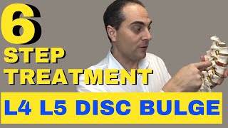 6 Step L4 L5 Disc Bulge Treatment L4 L5 Bulging Disc Treatment by Dr Walter Salubro [upl. by Ferdy]