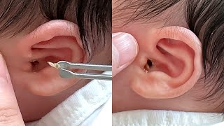 인생 첫 귀지와 귀청소 마사지  Ear Cleaning and massage 耳掃除 14 [upl. by Church]