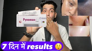 Pynomax tx cream  pynomax cream use  Pynomax tx cream how to use  Pynomax tx cream side effects [upl. by Rockie17]