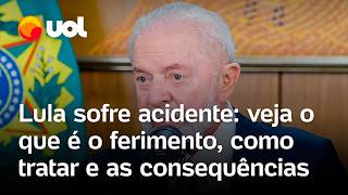 Lula sofre acidente veja o que é ferimento cortocontuso onde fica região occipital e como tratar [upl. by Philipp]