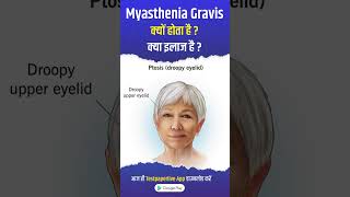 Myasthenia Gravis cause Symptoms and Treatment myastheniagravis causes symptoms treatment [upl. by Irret]