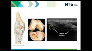 Anatomie en echografie knie deel 1 [upl. by Aliehc]