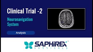 Clinical Trial  2 Neuronavigation System [upl. by Asenav]