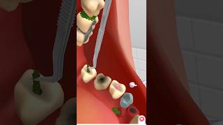 teeth cleaning by animation animation treatment kidsvideo satisfying relax [upl. by Akired449]