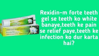 Rexidinm forte teeth gel review [upl. by Zigrang847]