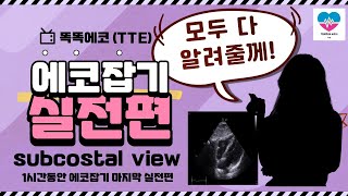 심장초음파 실전 Subcostal 4chamber view 잡기 echocardiography 심장초음파 TTE sonography rdcs cardiology [upl. by Irabaj]